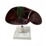 LIVER MODEL